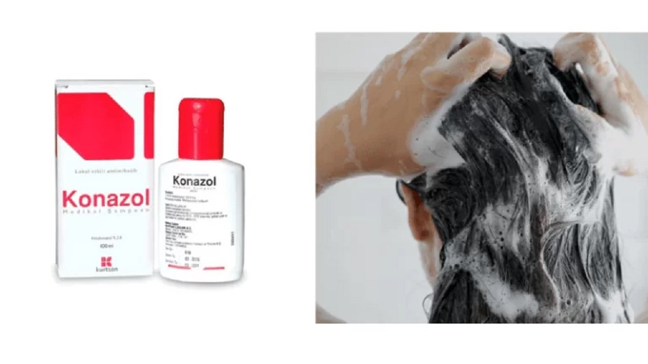 Konazol Şampuan Vücutta Kullanılır mı 