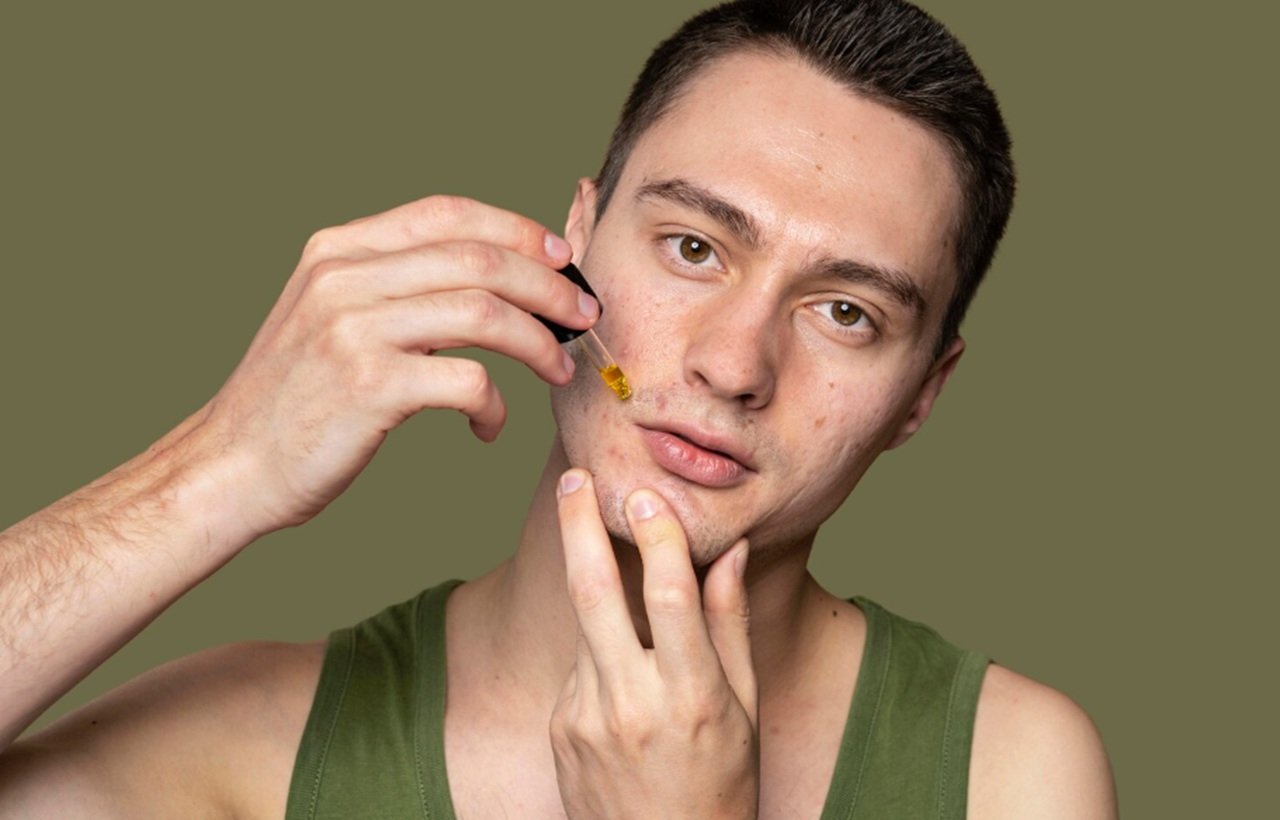 Akne Eğilimli Ciltlerde Leke ve Yaşlanma Karşıtı Bakım 1 akne-egilimli-ciltlerde-leke-ve-yaslanma-karsiti-bakim