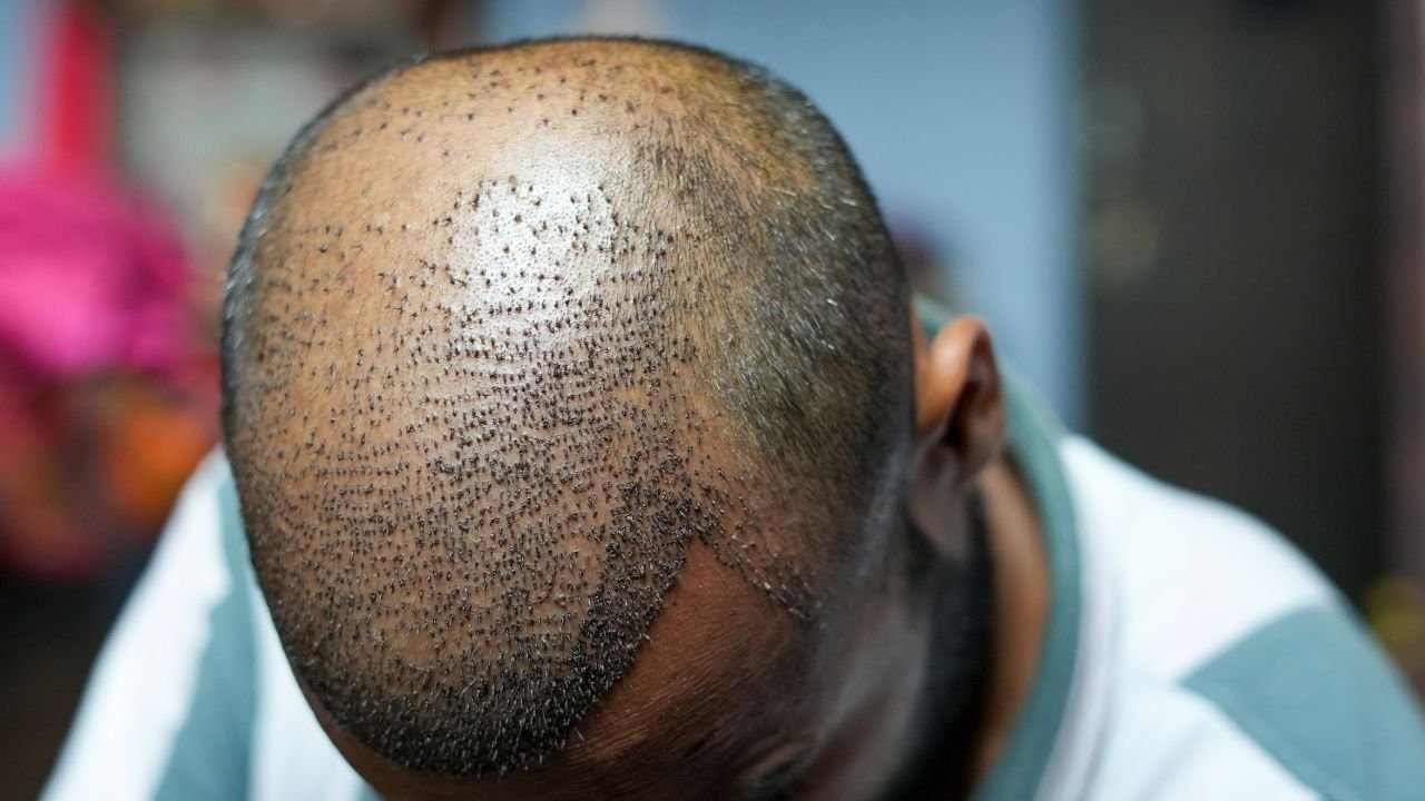 Saçın Picassosu Dr. Servet Terziler Kimdir? 5 dr-servet-terziler-kimdir (3)