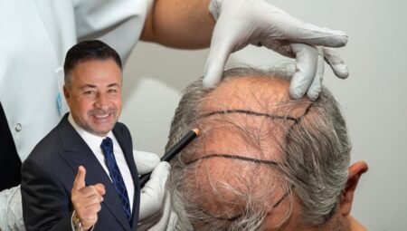 Saçın Picassosu Dr. Servet Terziler Kimdir?