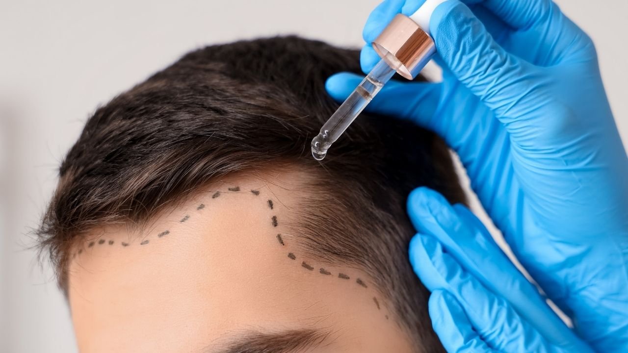 Saçın Picassosu Dr. Servet Terziler Kimdir? 2 dr-servet-terziler-kimdir